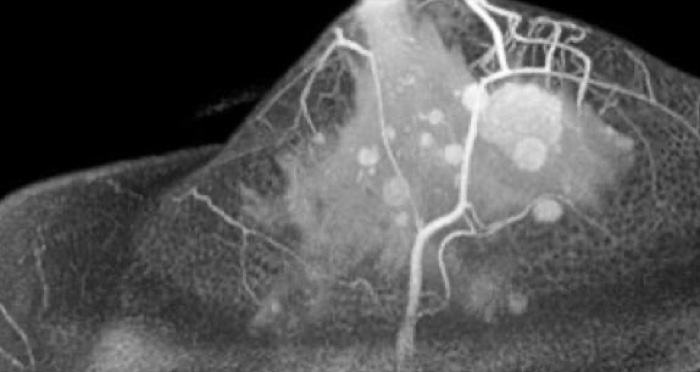 MRI Alternative