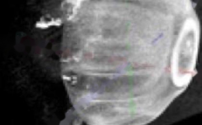 True 3D Imaging